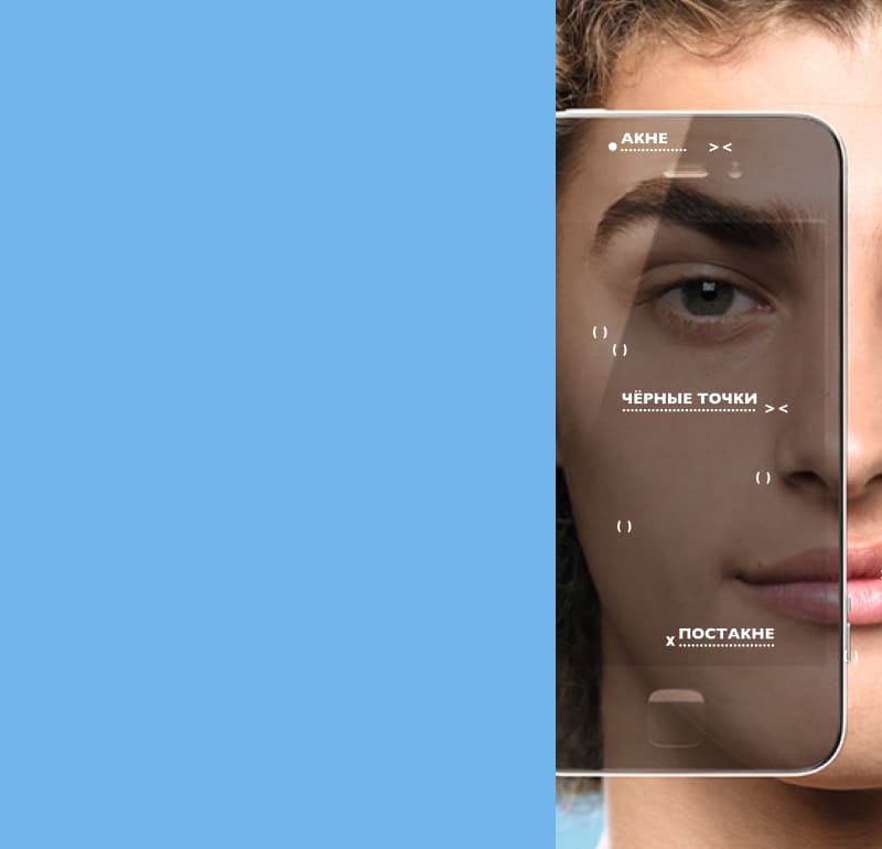 SkinConsult