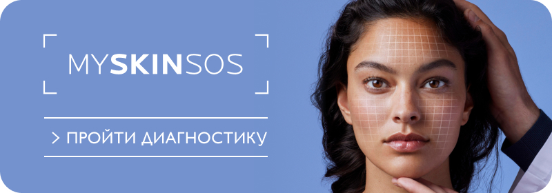 myskinsos diagnostic