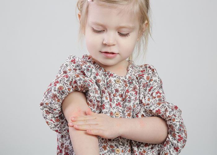 Атопический дерматит у детей и уход за кожей, склонной к атопии