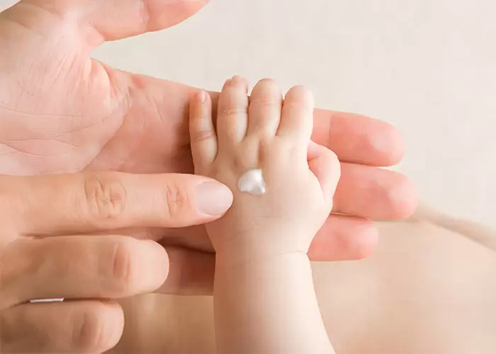 Нужно ли лечить акне новорожденных?