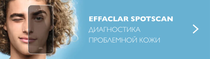 Spotscan - диагностика проблемной кожи